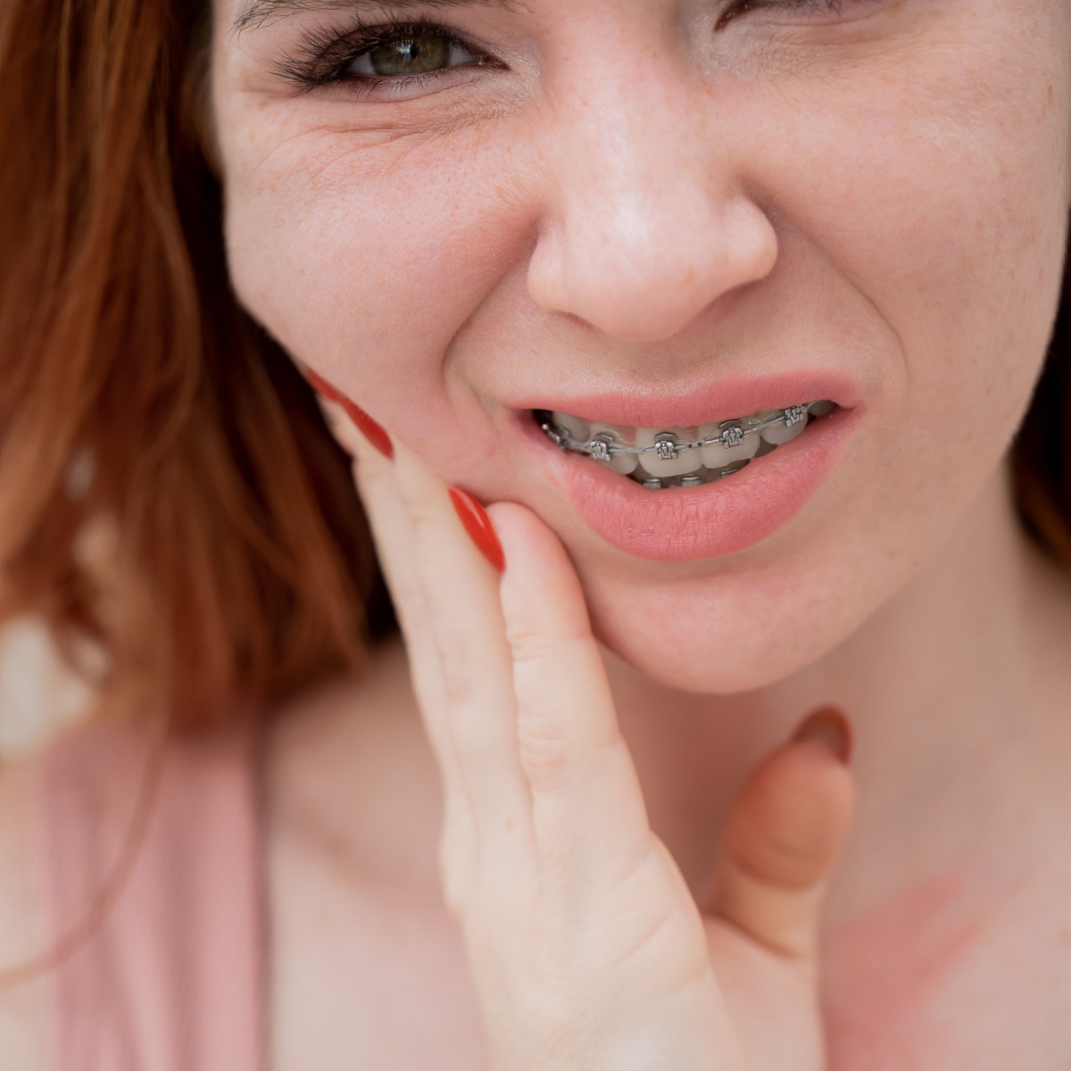 How to Deal with Discomfort from South Houston Braces