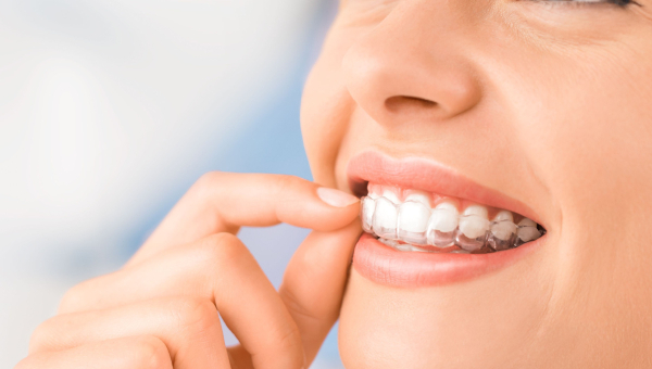 Best Practices for Dental Hygiene with South Houston Invisalign
