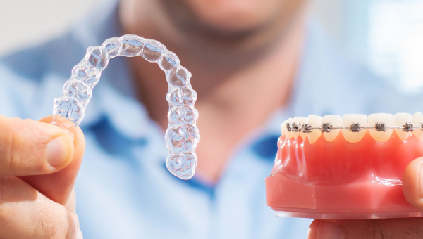 Are Metal Houston Braces Better Than Ceramic and Invisalign?