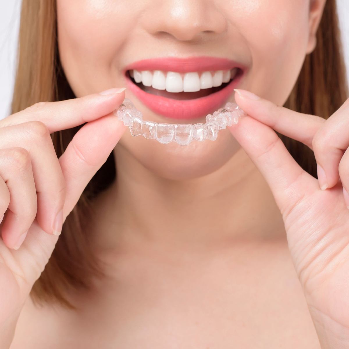Invisalign: Discreet South Houston Braces for Adults