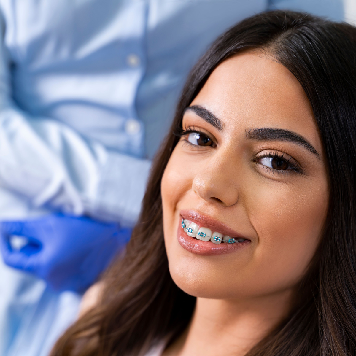 Consult your South Houston dentist how to keep your braces in perfect condition.