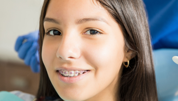 Living with South Houston Braces: What to Expect in the First Week