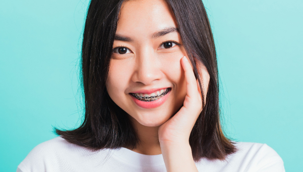 Top 5 Reasons You May Need South Houston Braces in 2025