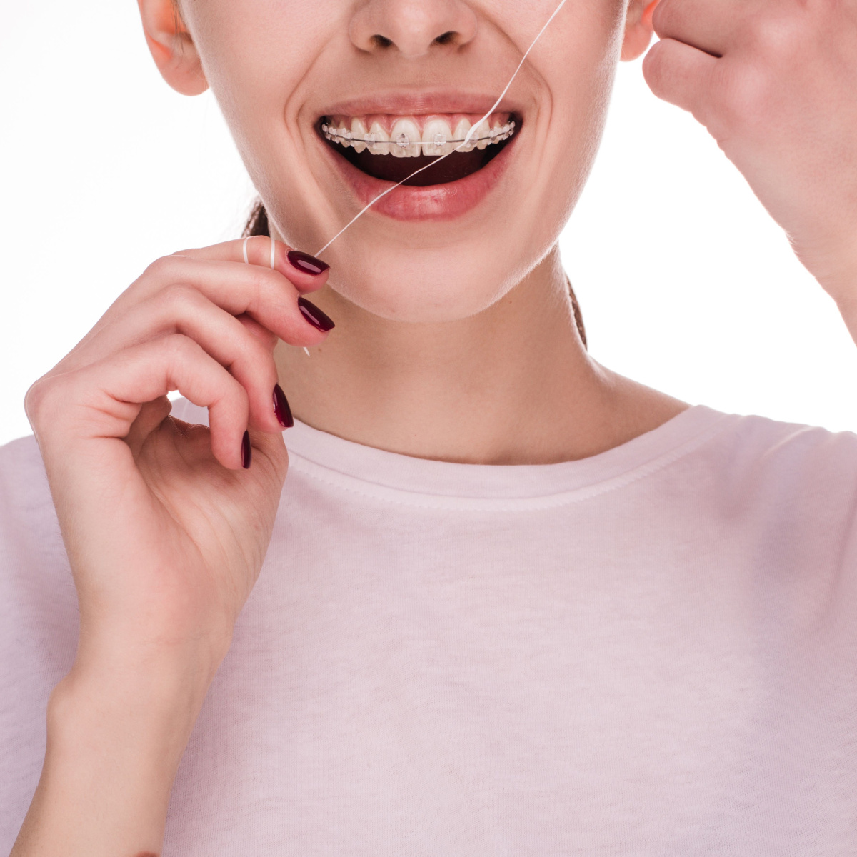 Keep your South Houston braces in tip top shape with these tips.