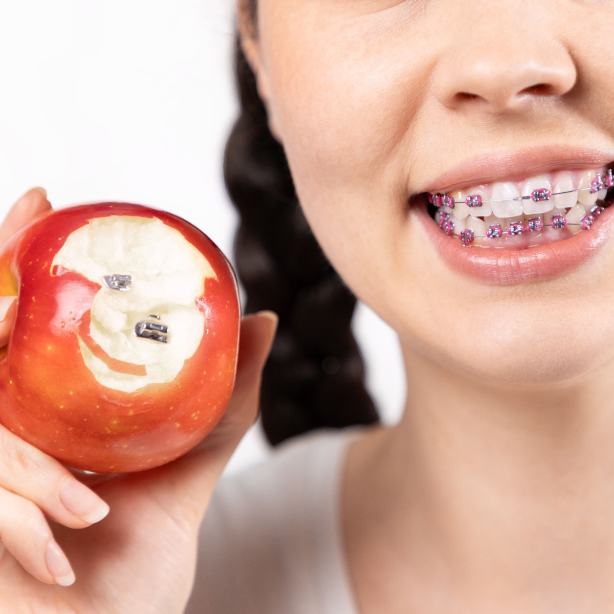 Maintaining oral hygiene with Houston braces