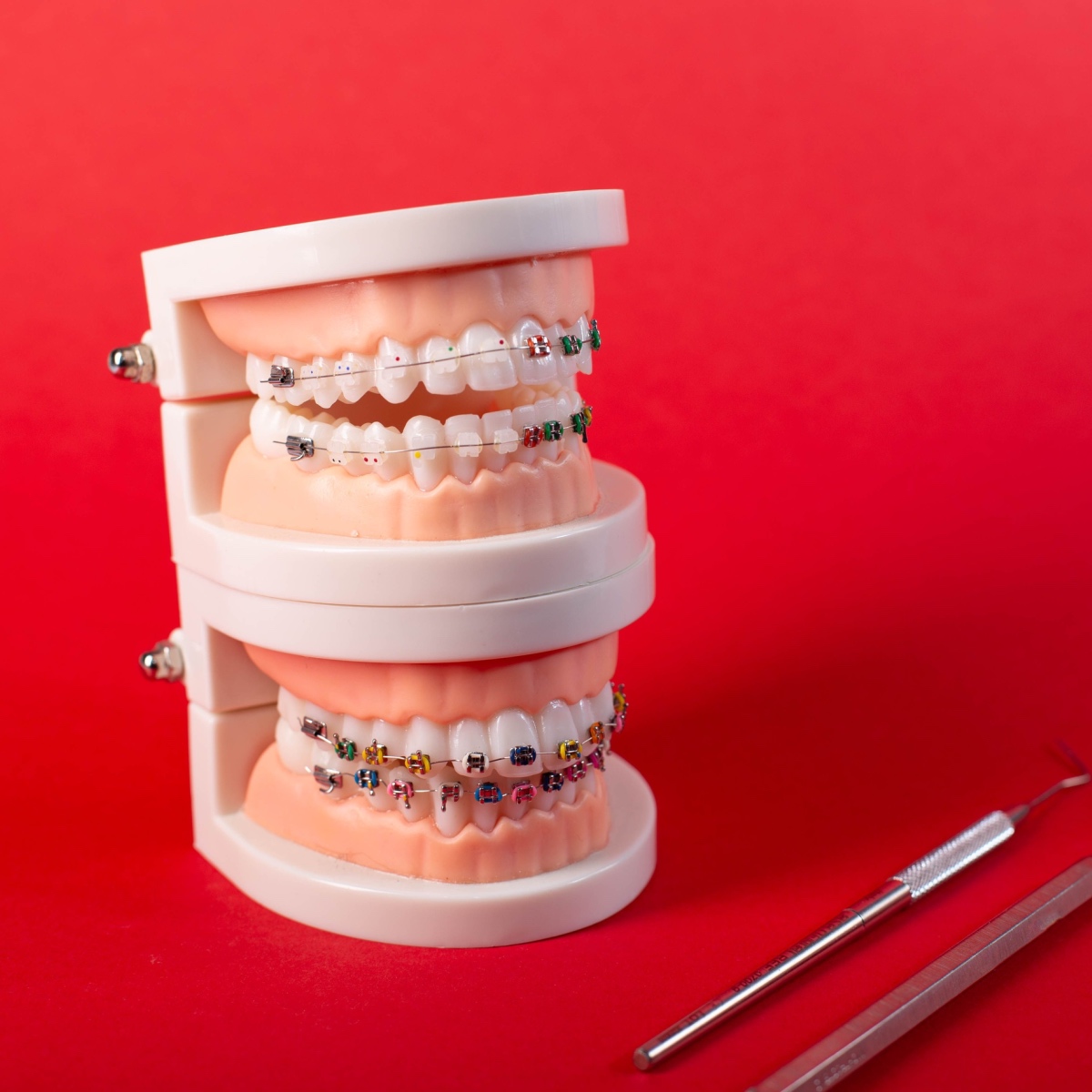 Choosing the right type of South Houston braces